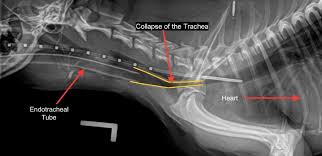 Severe Tracheal Collapse